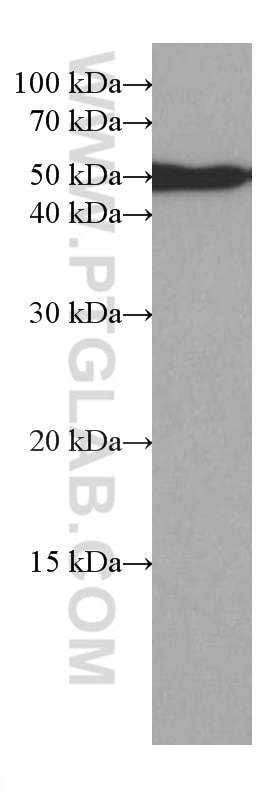 Western Blot (WB) analysis of A549 cells using TFG Monoclonal antibody (66916-1-Ig)