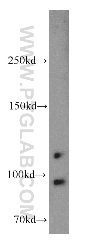 Western Blot (WB) analysis of mouse testis tissue using TFIP11 Polyclonal antibody (14436-1-AP)