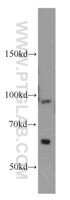 Western Blot (WB) analysis of HeLa cells using TFIP11 Polyclonal antibody (14436-1-AP)