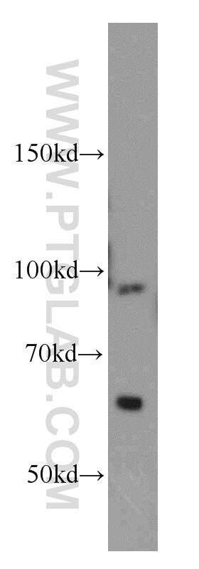 WB analysis of HeLa using 14436-1-AP