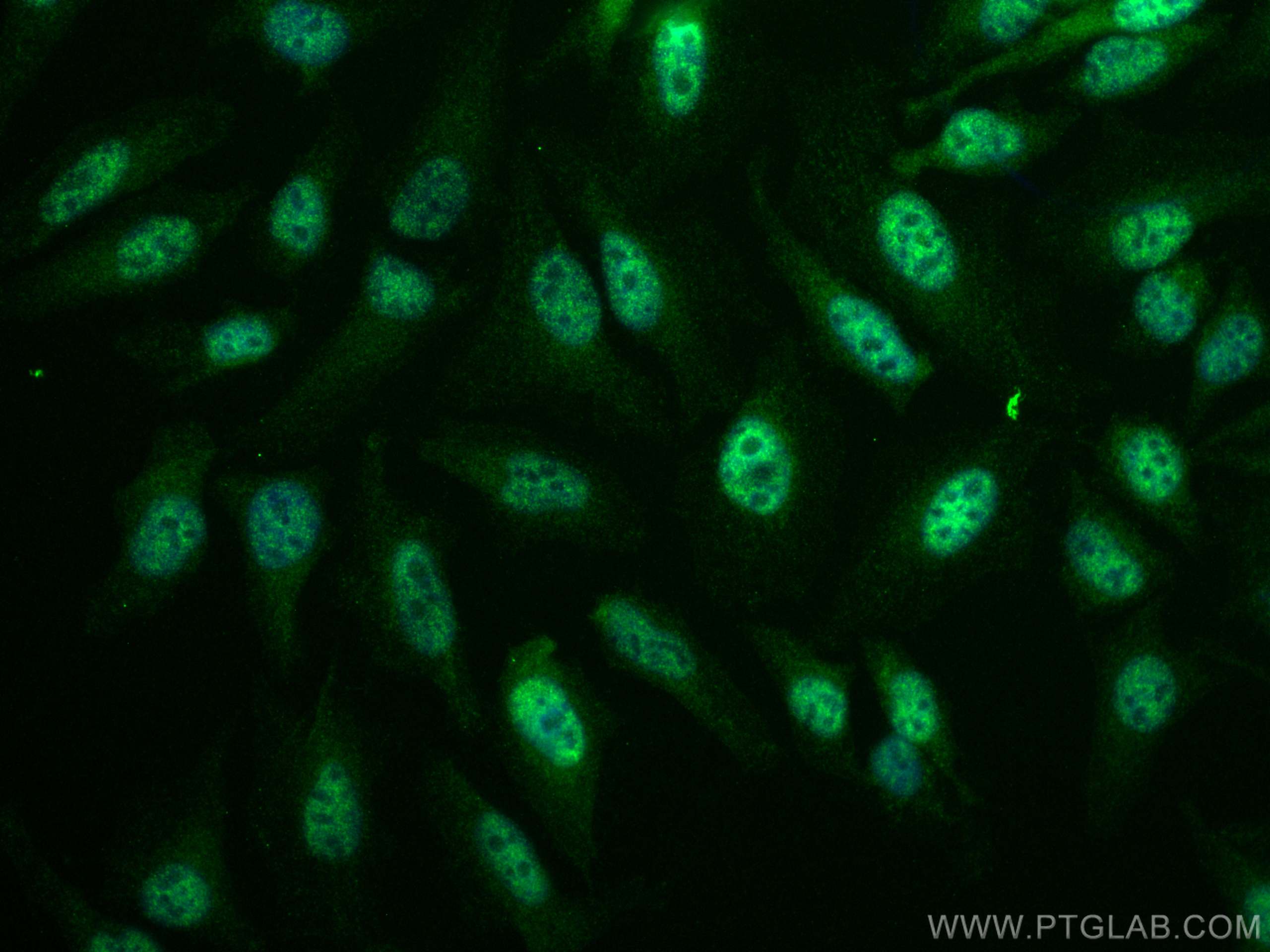 Immunofluorescence (IF) / fluorescent staining of HeLa cells using TFIP11 Monoclonal antibody (66114-1-Ig)