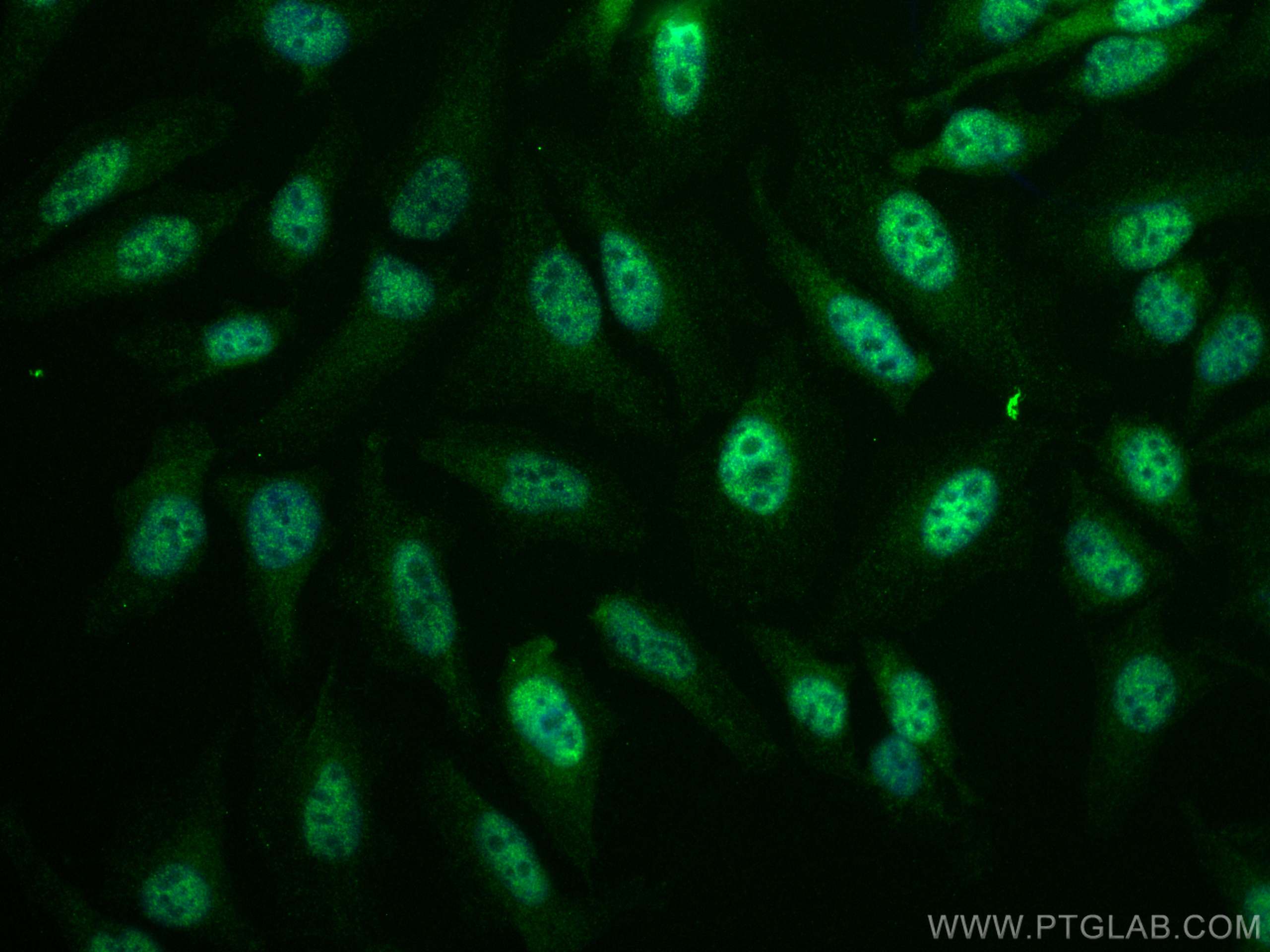 Immunofluorescence (IF) / fluorescent staining of HeLa cells using TFIP11 Monoclonal antibody (66114-1-Ig)