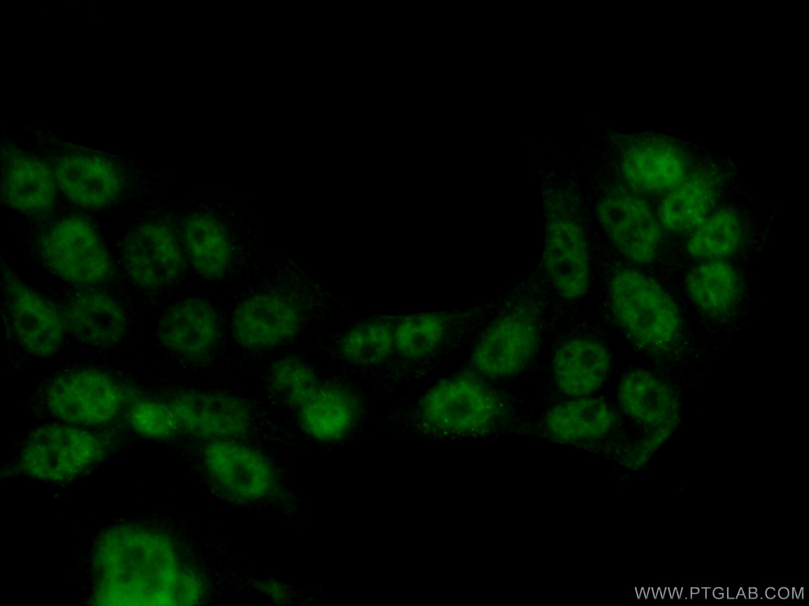 Immunofluorescence (IF) / fluorescent staining of HeLa cells using TFIP11 Monoclonal antibody (66114-1-Ig)