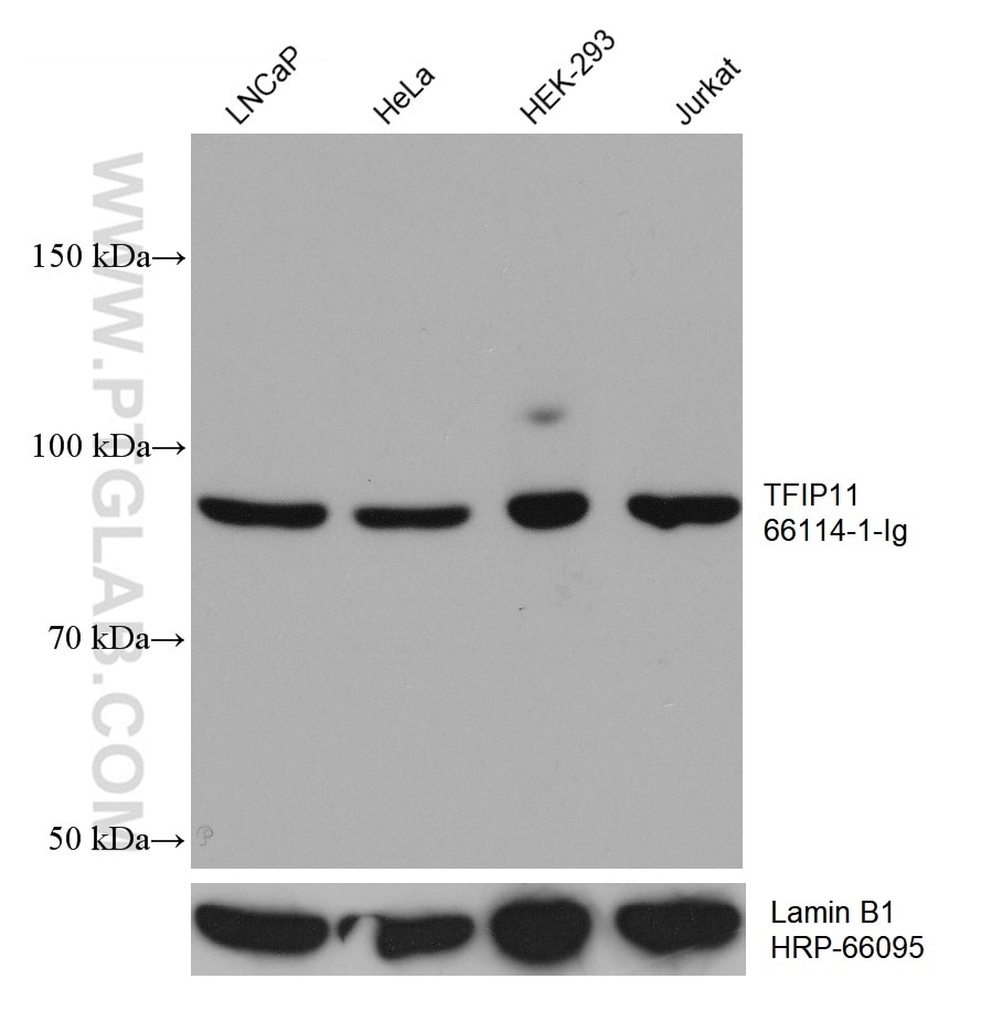 WB analysis using 66114-1-Ig