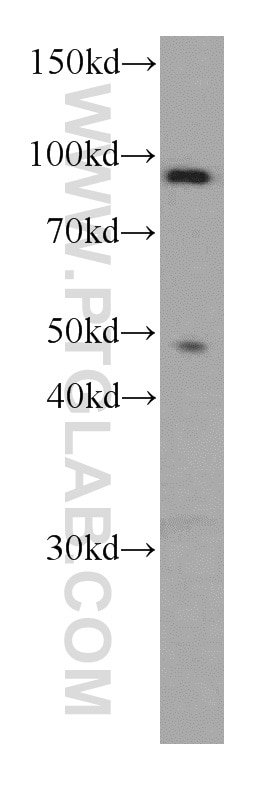 Western Blot (WB) analysis of human testis tissue using TFIP11 Monoclonal antibody (66114-1-Ig)