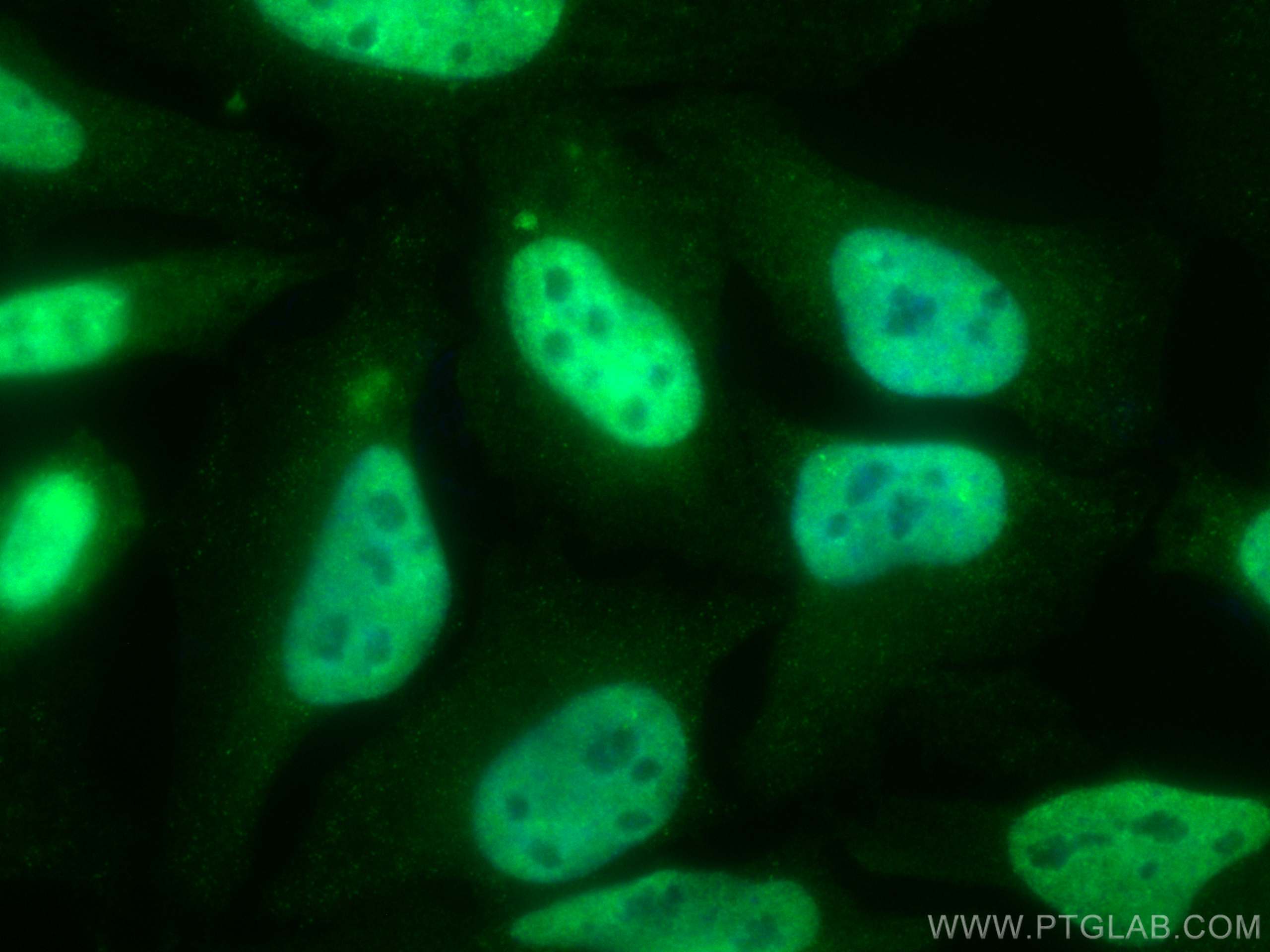 Immunofluorescence (IF) / fluorescent staining of HeLa cells using CoraLite® Plus 488-conjugated TFIP11 Monoclonal an (CL488-66114)
