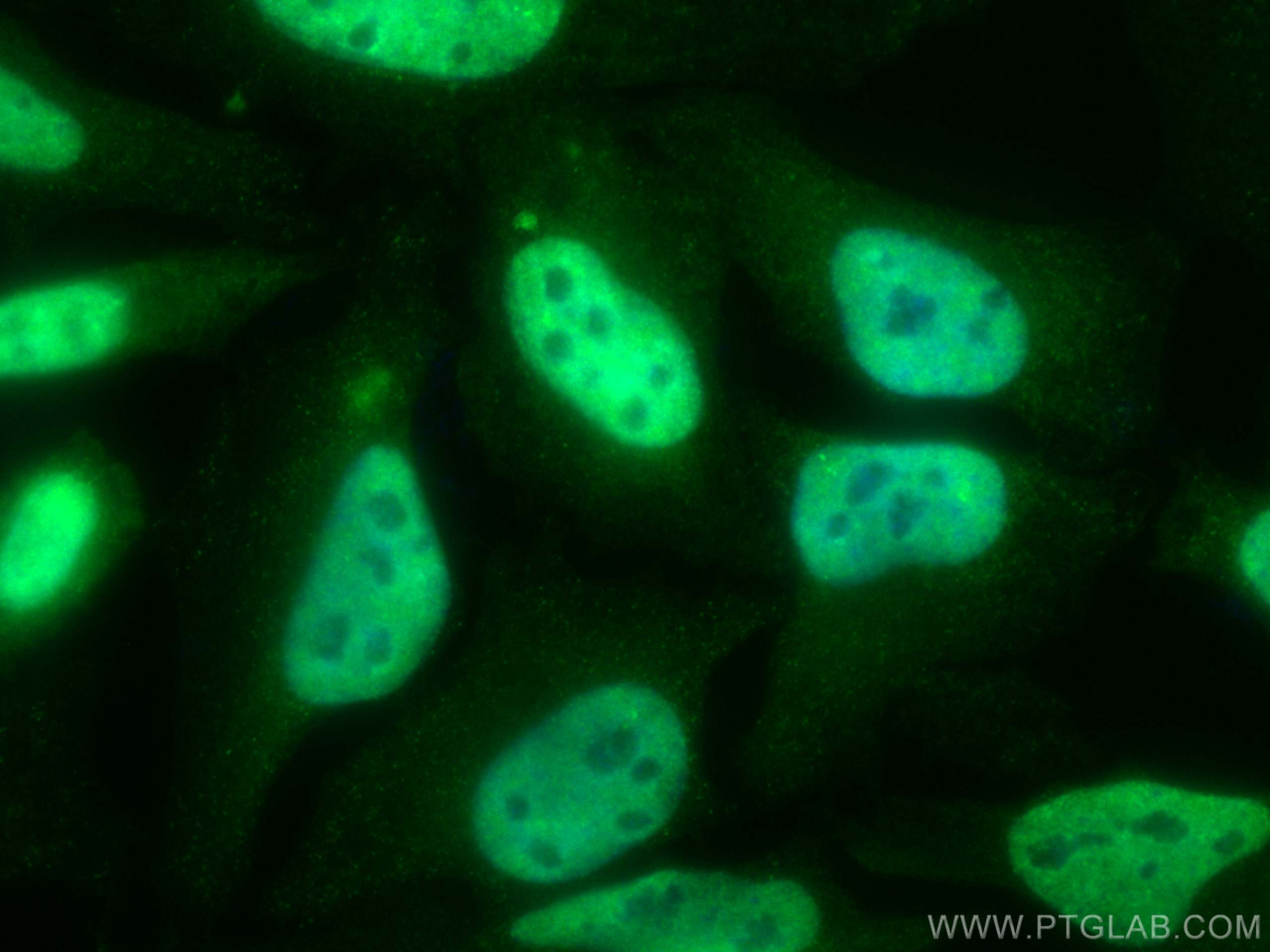 IF Staining of HeLa using CL488-66114