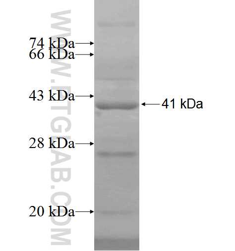 TFIP11 fusion protein Ag5821 SDS-PAGE
