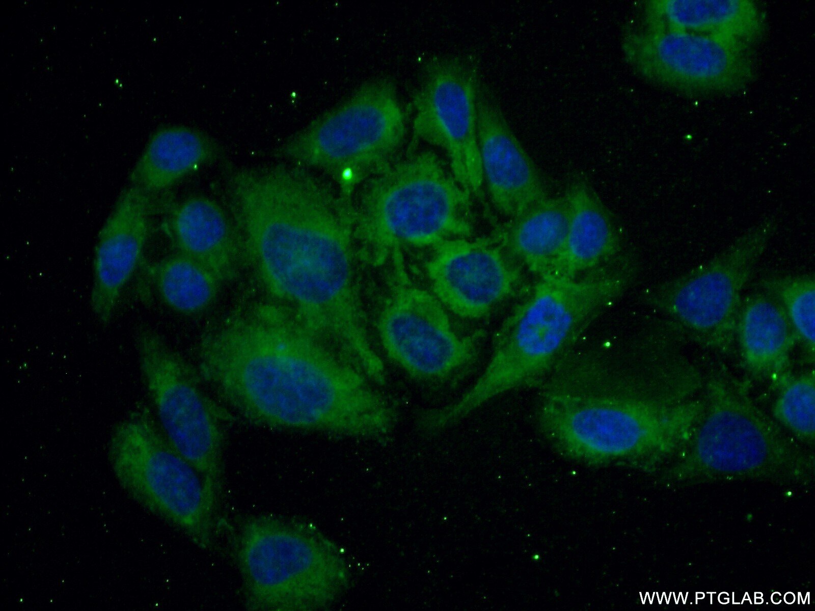 IF Staining of HepG2 using 20865-1-AP