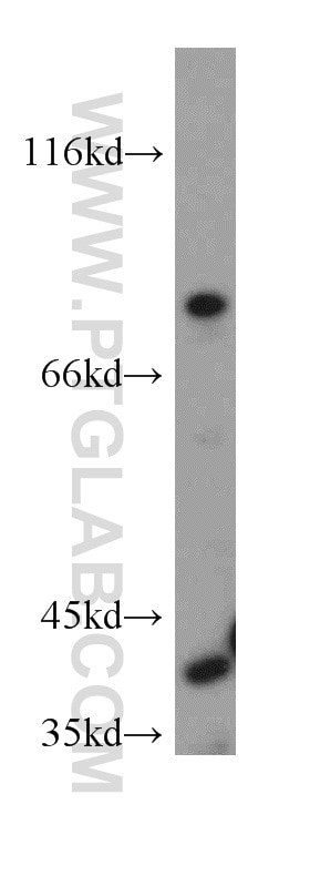 Western Blot (WB) analysis of HeLa cells using TFPI Polyclonal antibody (20865-1-AP)