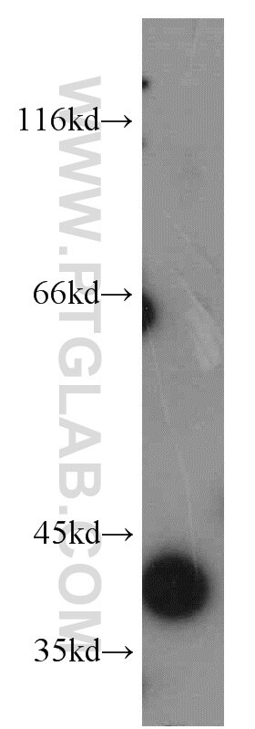 Western Blot (WB) analysis of HepG2 cells using TFPI Polyclonal antibody (20865-1-AP)