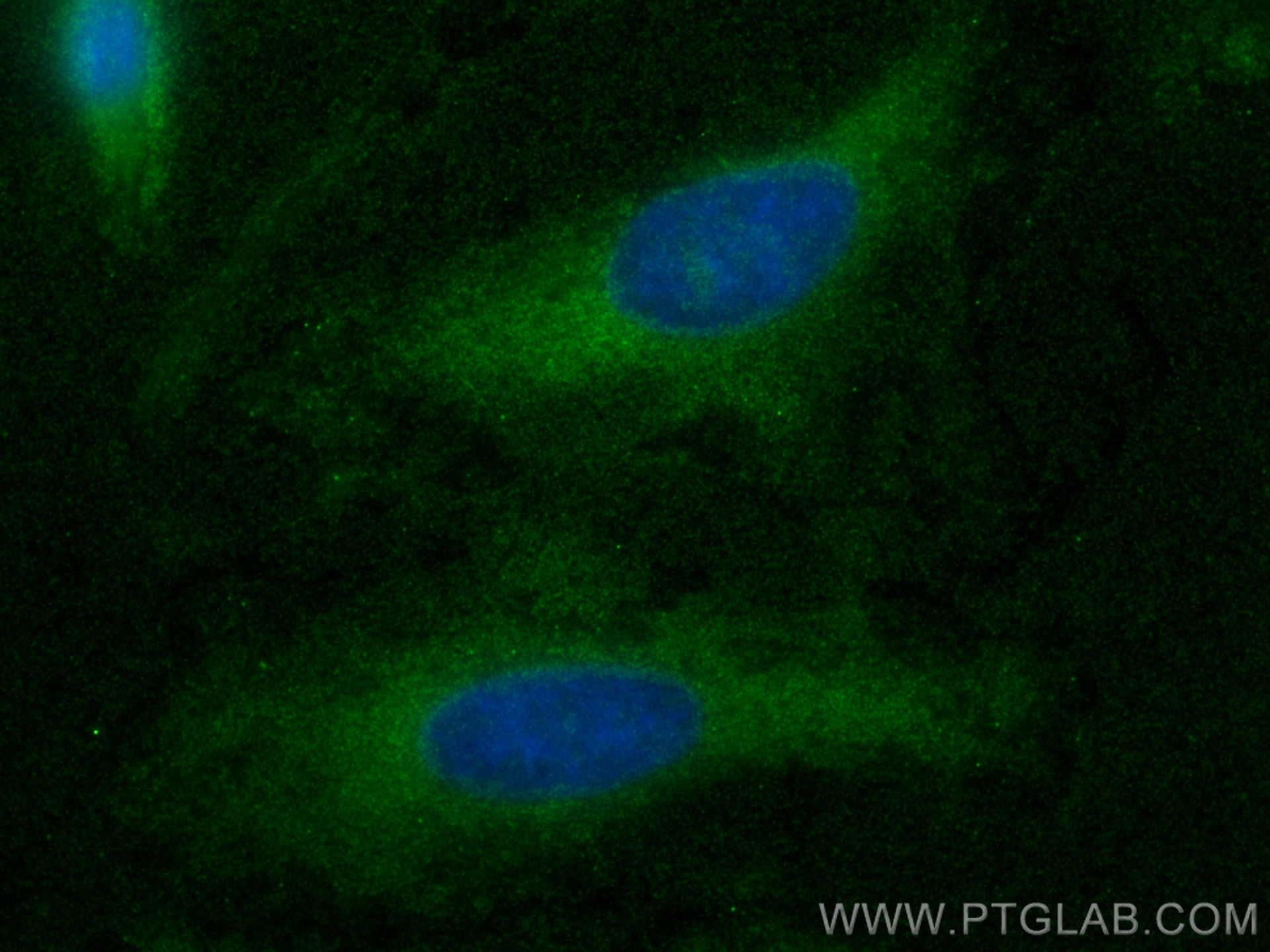 Immunofluorescence (IF) / fluorescent staining of HeLa cells using TFPI Monoclonal antibody (66842-1-Ig)
