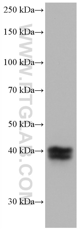 Western Blot (WB) analysis of human placenta tissue using TFPI Monoclonal antibody (66842-1-Ig)