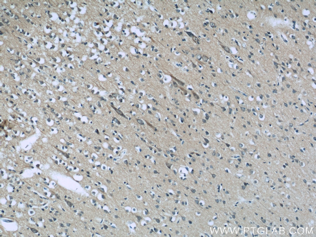 Immunohistochemistry (IHC) staining of human brain tissue using TFPT Polyclonal antibody (10097-2-AP)