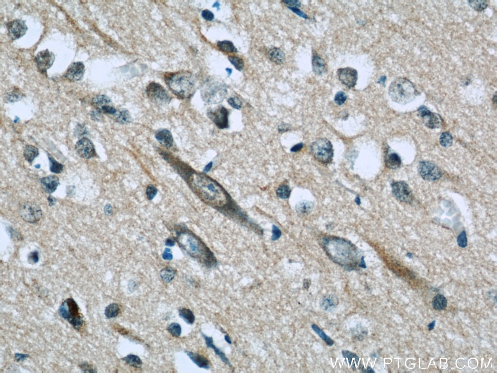 Immunohistochemistry (IHC) staining of human brain tissue using TFPT Polyclonal antibody (10097-2-AP)