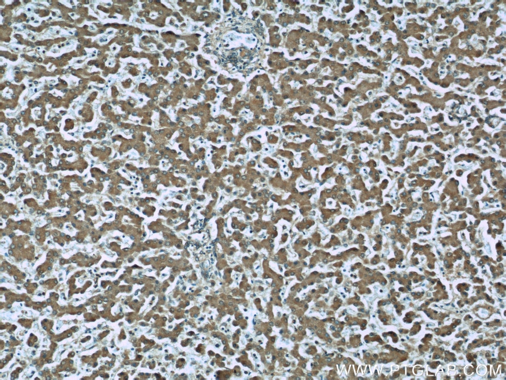 Immunohistochemistry (IHC) staining of human liver tissue using TFPT Polyclonal antibody (10097-2-AP)