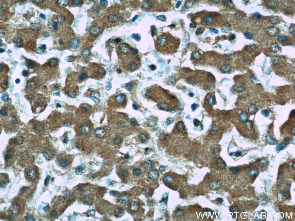 Immunohistochemistry (IHC) staining of human liver tissue using TFPT Polyclonal antibody (10097-2-AP)