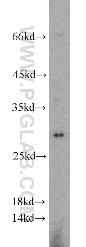 Western Blot (WB) analysis of PC-3 cells using TFPT Polyclonal antibody (10097-2-AP)