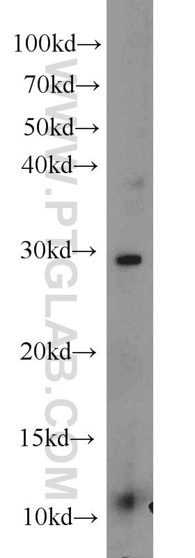 Western Blot (WB) analysis of K-562 cells using TFPT Polyclonal antibody (10097-2-AP)