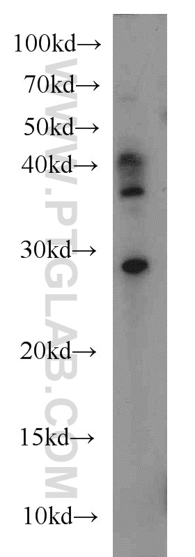 Western Blot (WB) analysis of HL-60 cells using TFPT Polyclonal antibody (10097-2-AP)
