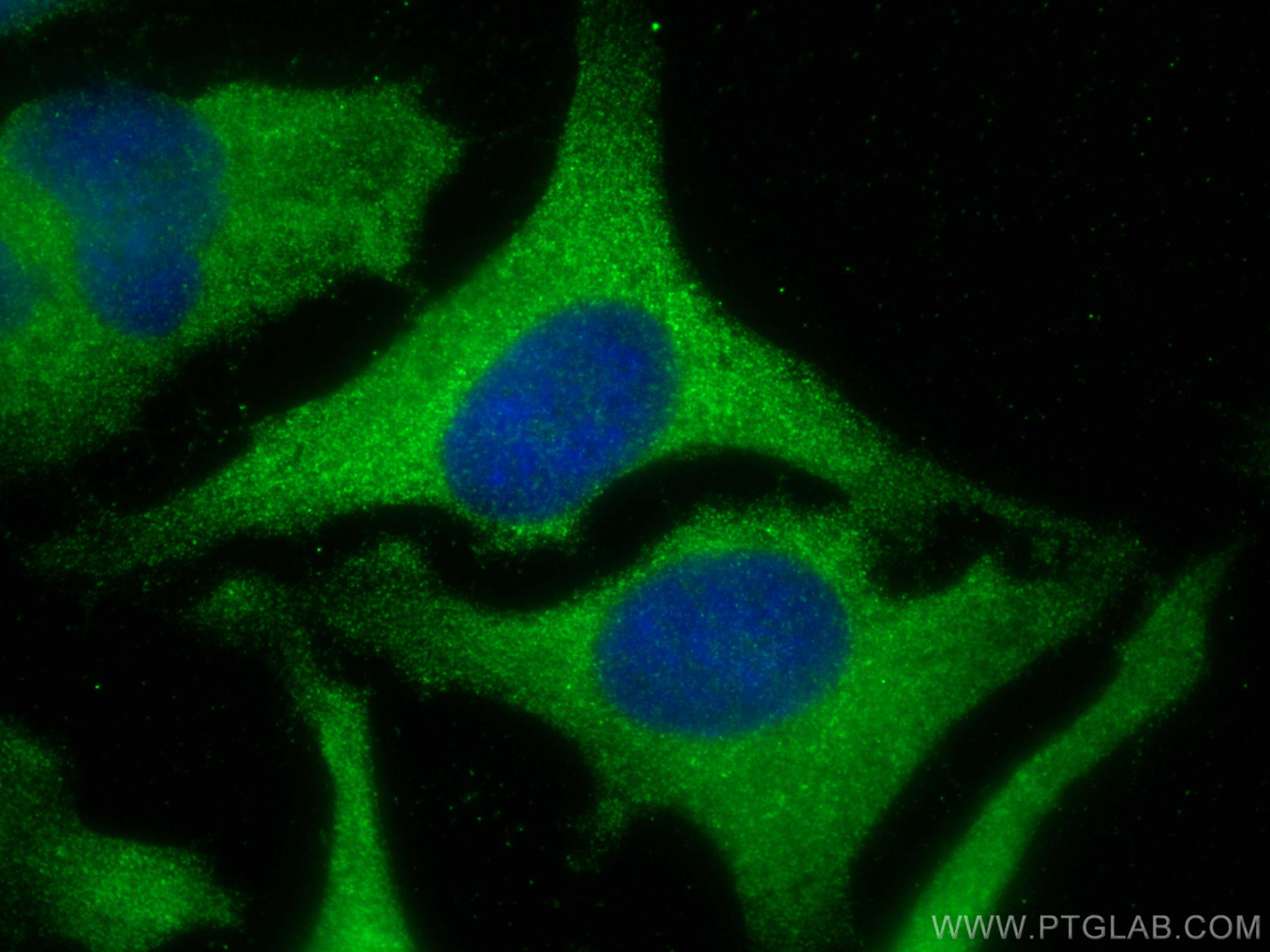 Immunofluorescence (IF) / fluorescent staining of HeLa cells using CD71 Polyclonal antibody (10084-2-AP)