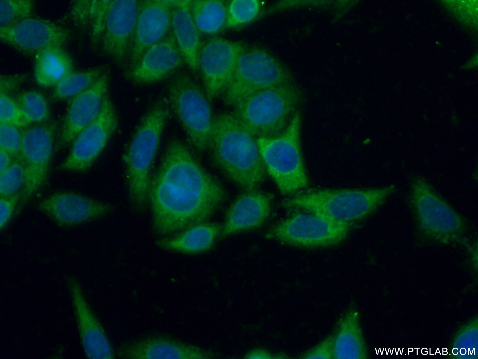 Immunofluorescence (IF) / fluorescent staining of HeLa cells using CD71 Polyclonal antibody (10084-2-AP)