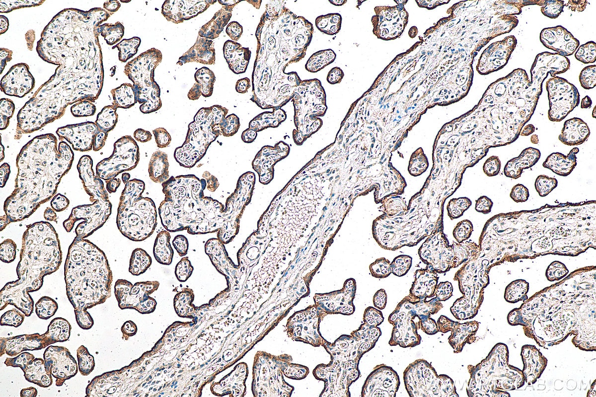 Immunohistochemistry (IHC) staining of human placenta tissue using CD71 Polyclonal antibody (10084-2-AP)