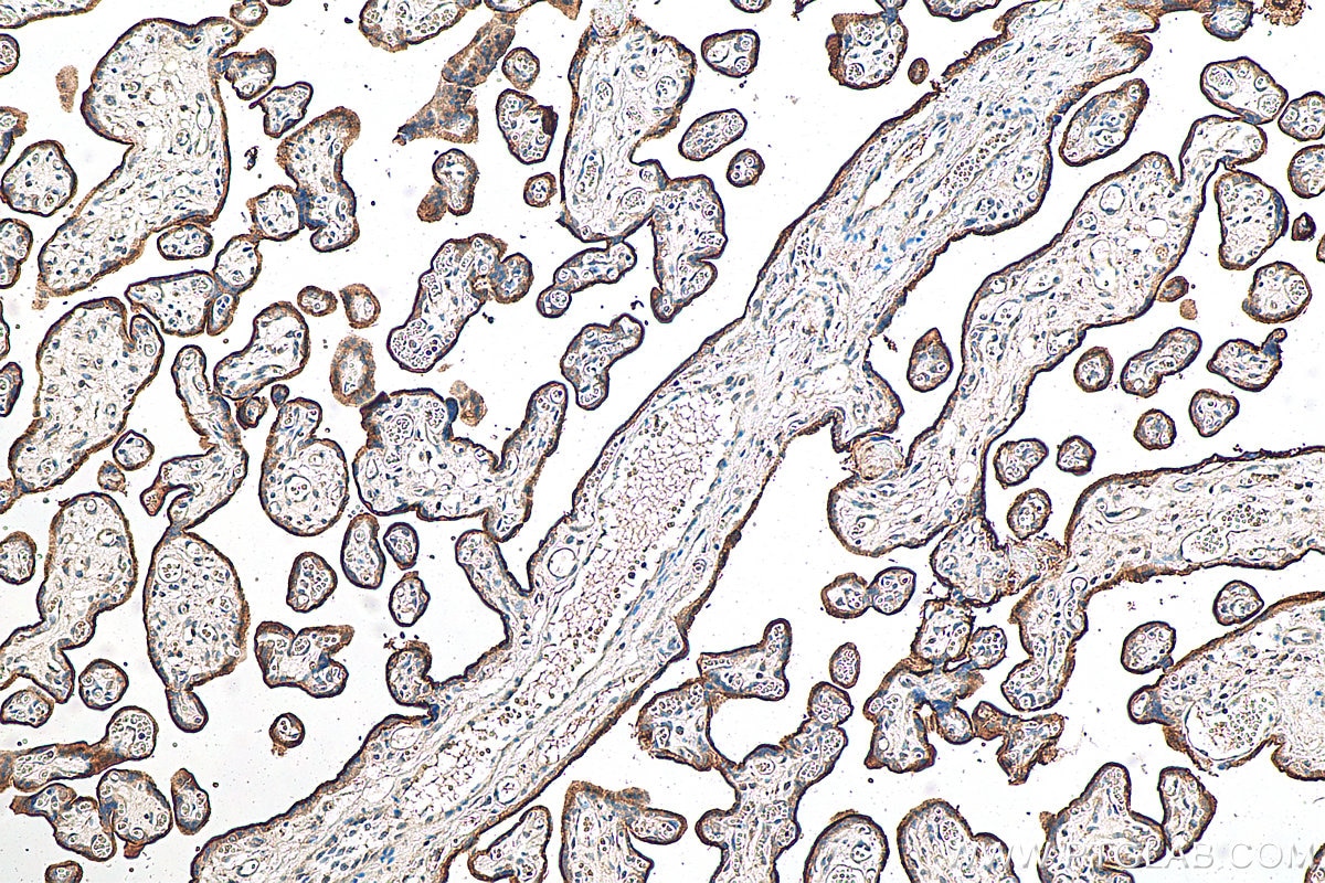 IHC staining of human placenta using 10084-2-AP