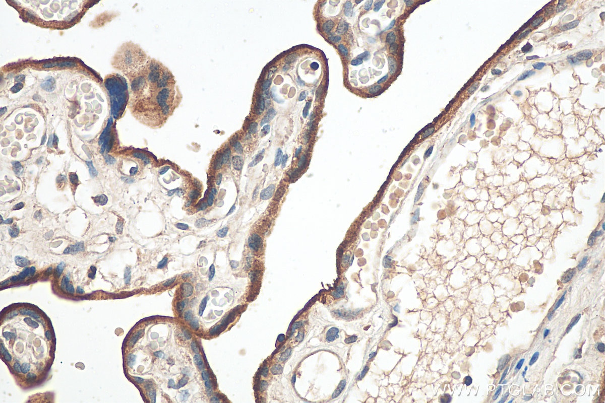 Immunohistochemistry (IHC) staining of human placenta tissue using CD71 Polyclonal antibody (10084-2-AP)