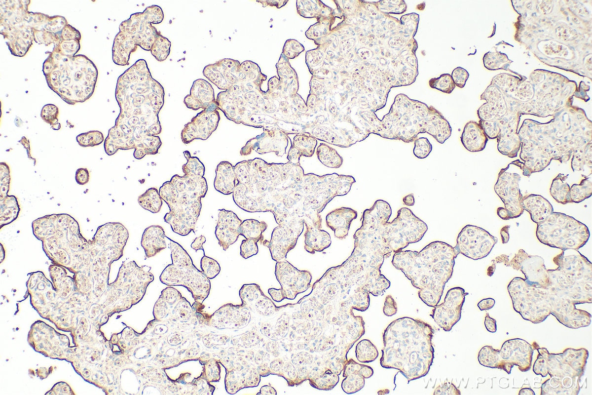 Immunohistochemistry (IHC) staining of human placenta tissue using CD71 Polyclonal antibody (10084-2-AP)