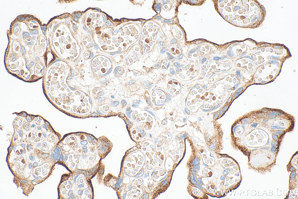 Immunohistochemistry (IHC) staining of human placenta tissue using CD71 Polyclonal antibody (10084-2-AP)