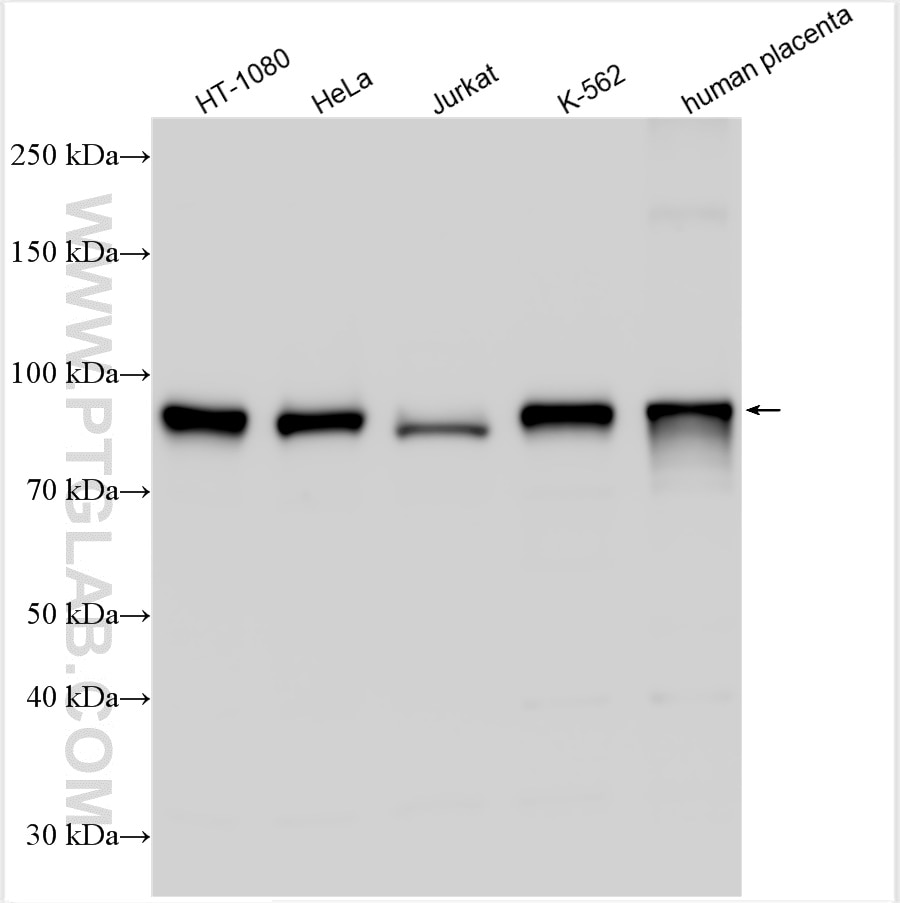 Western Blot (WB) analysis of various lysates using CD71 Polyclonal antibody (10084-2-AP)