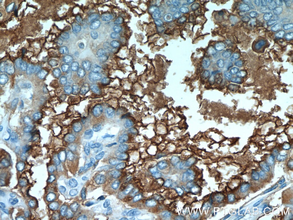 Thyroglobulin Polyclonal antibody