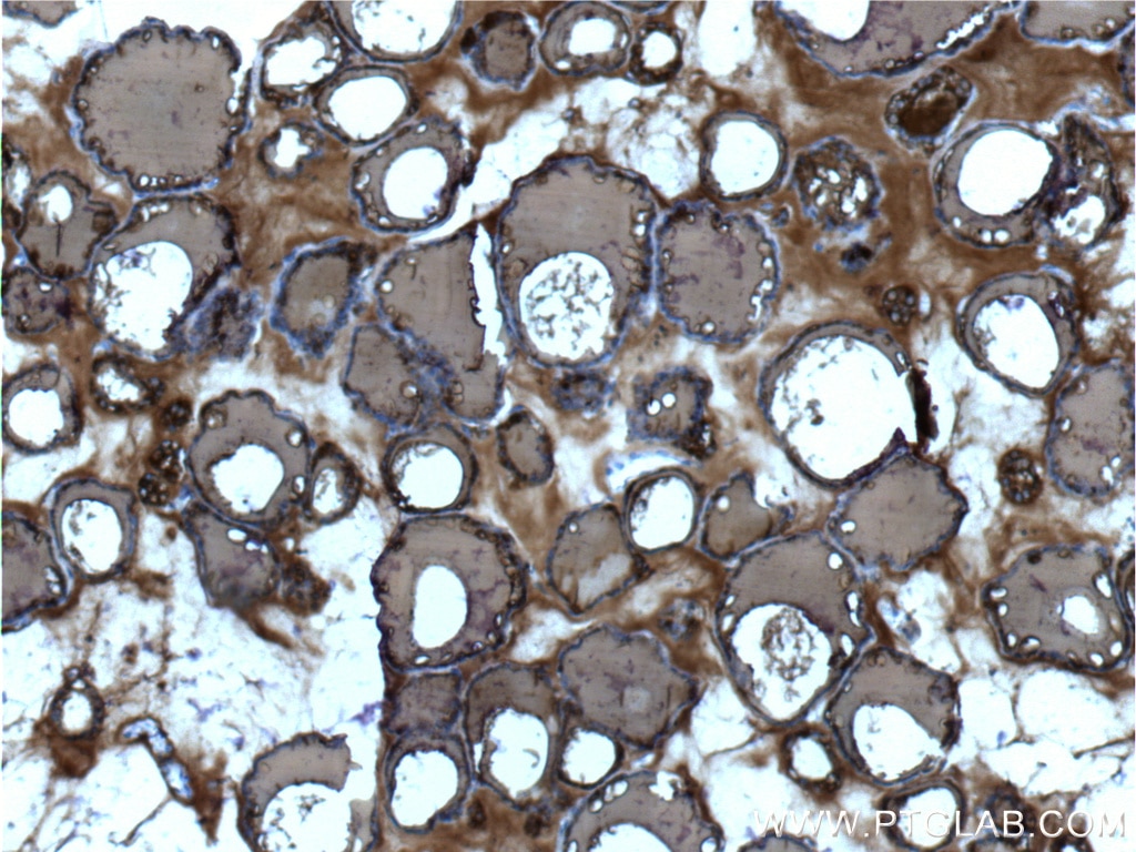 Immunohistochemistry (IHC) staining of human thyroid tissue using Thyroglobulin Monoclonal antibody (60272-1-Ig)
