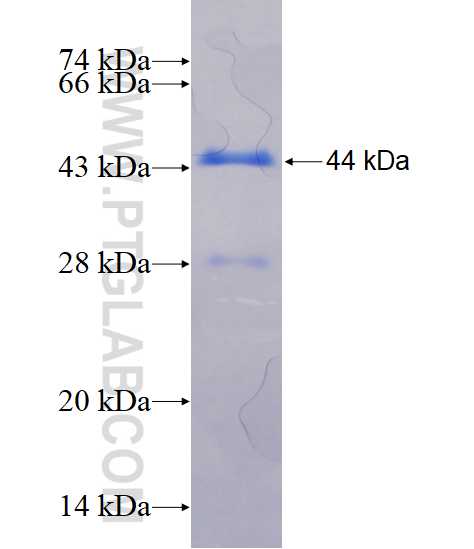 TG fusion protein Ag18070 SDS-PAGE