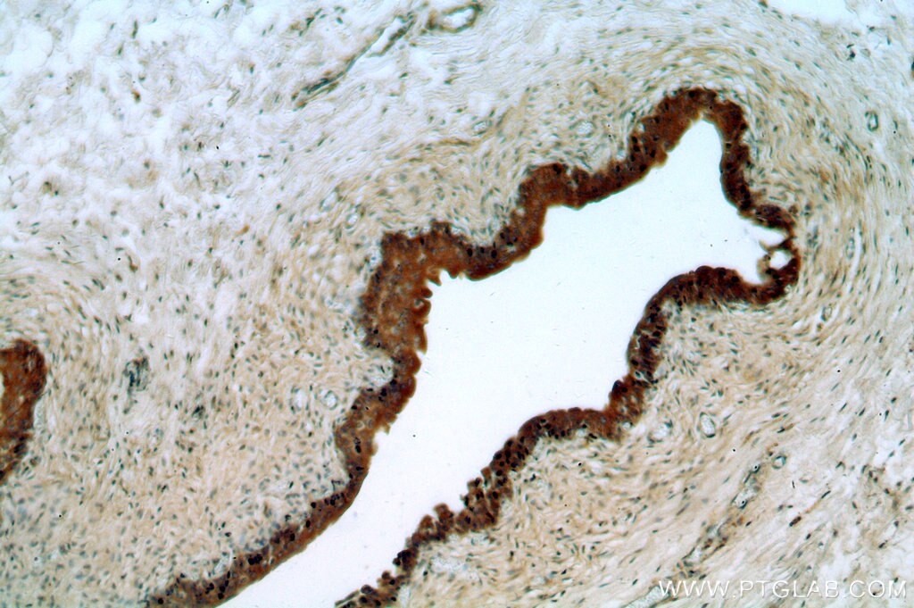 IHC staining of human bladder using 17310-1-AP