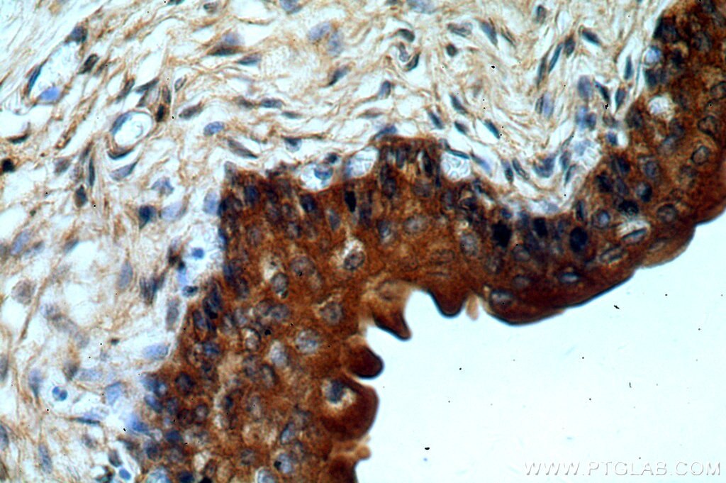 IHC staining of human bladder using 17310-1-AP