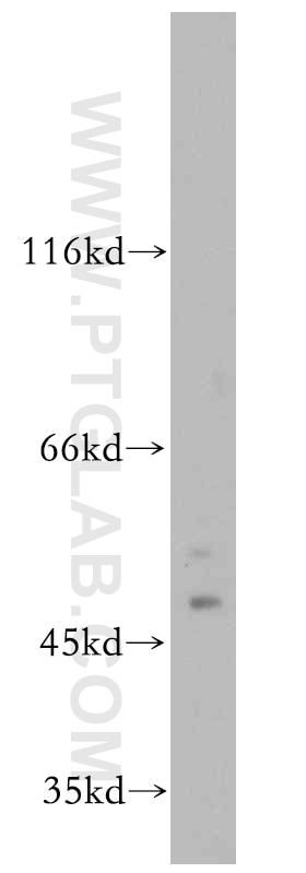 Western Blot (WB) analysis of mouse kidney tissue using TGDS Polyclonal antibody (17310-1-AP)