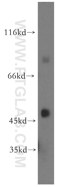 Western Blot (WB) analysis of human kidney tissue using TGDS Polyclonal antibody (17310-1-AP)
