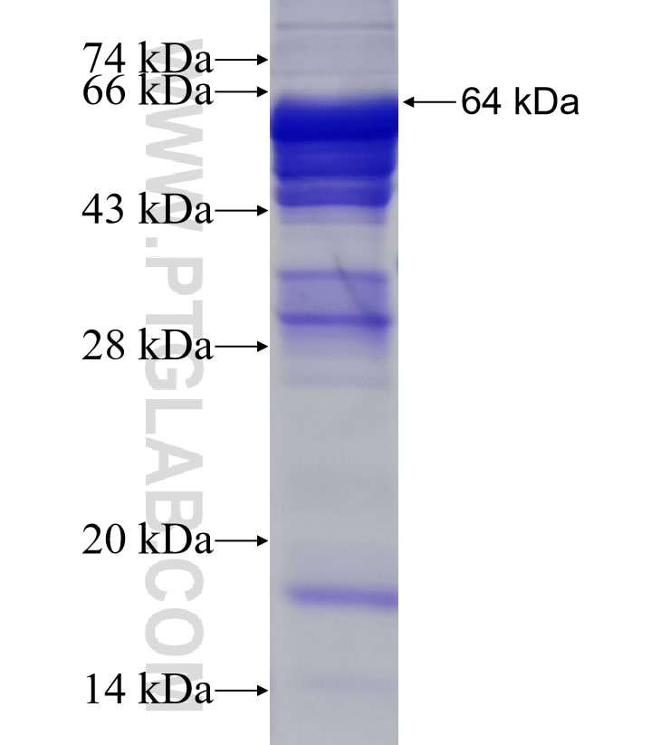 TGDS fusion protein Ag11276 SDS-PAGE