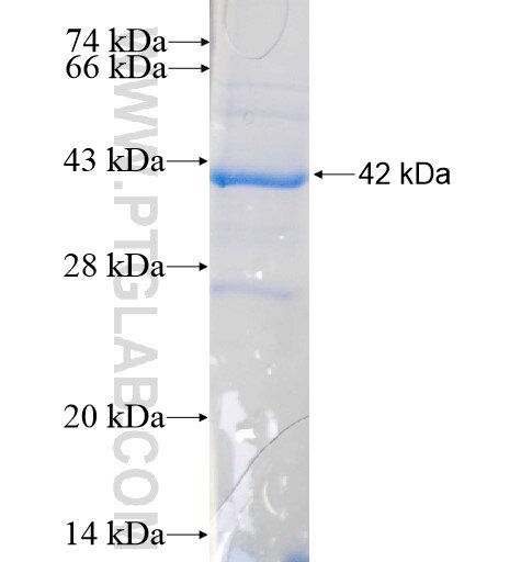 TGDS fusion protein Ag11469 SDS-PAGE