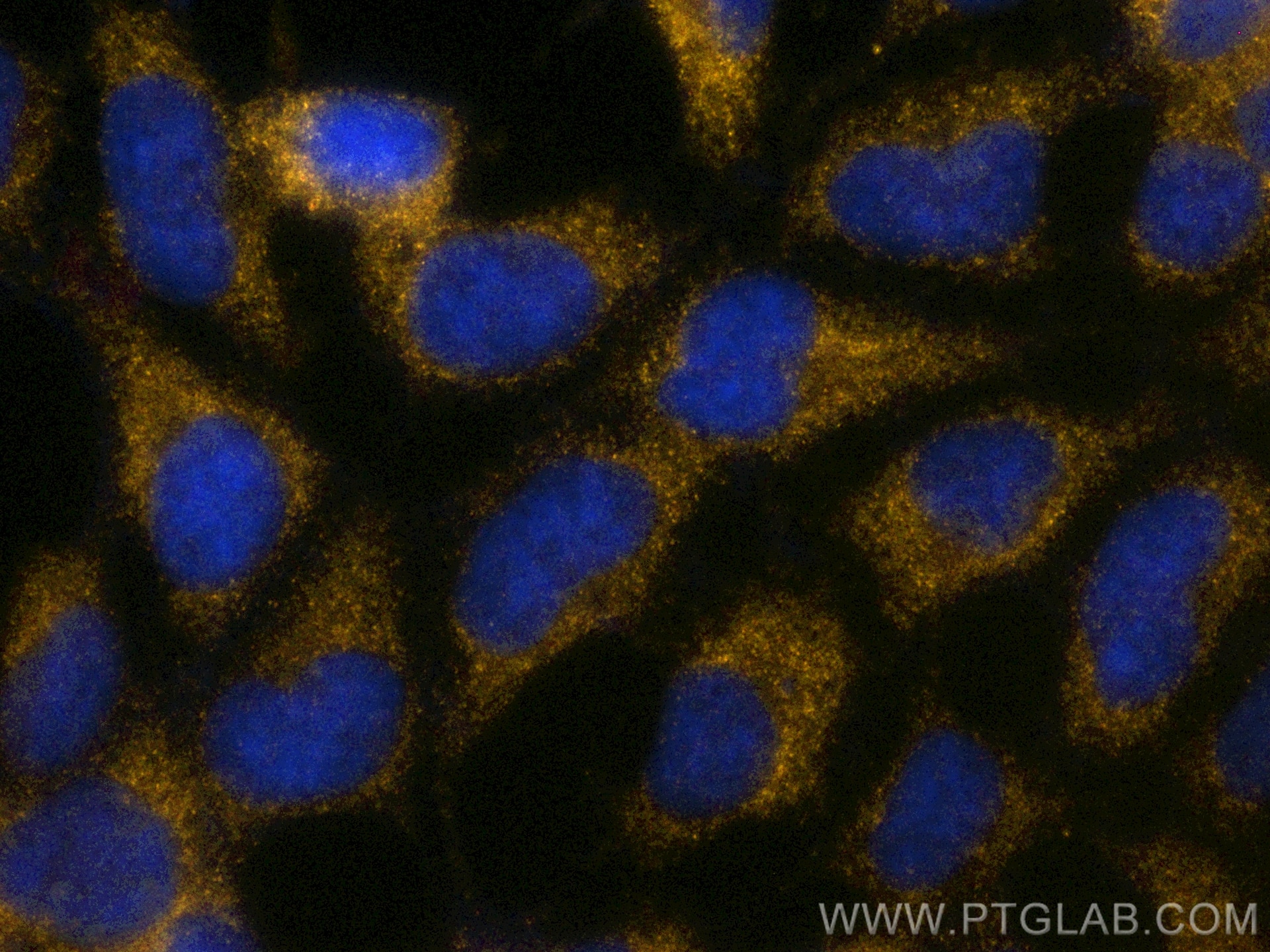 Immunofluorescence (IF) / fluorescent staining of HEK-293 cells using PE-conjugated TGF Beta 1 Recombinant antibody (PE-81746-2)