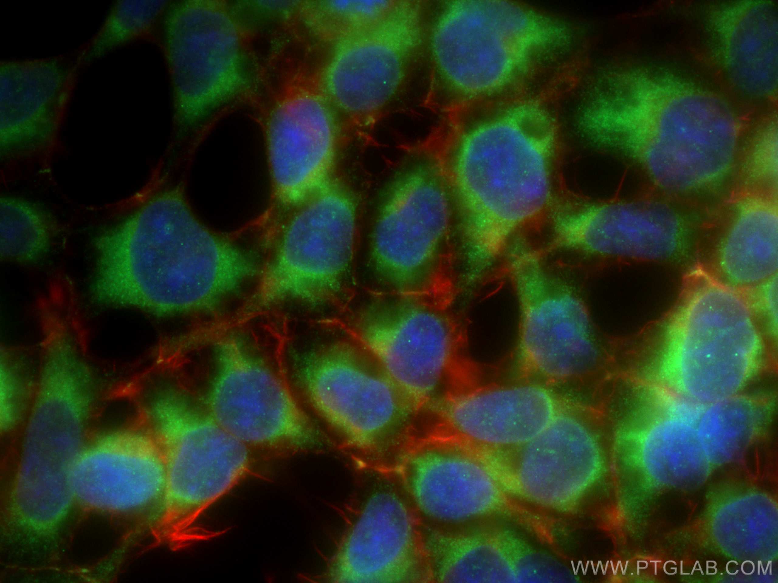 Immunofluorescence (IF) / fluorescent staining of HEK-293 cells using TGF Beta 1 Polyclonal antibody (21898-1-AP)