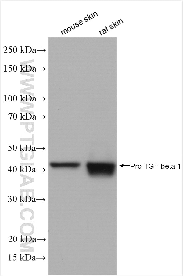 Western Blot (WB) analysis of various lysates using TGF Beta 1 Polyclonal antibody (21898-1-AP)