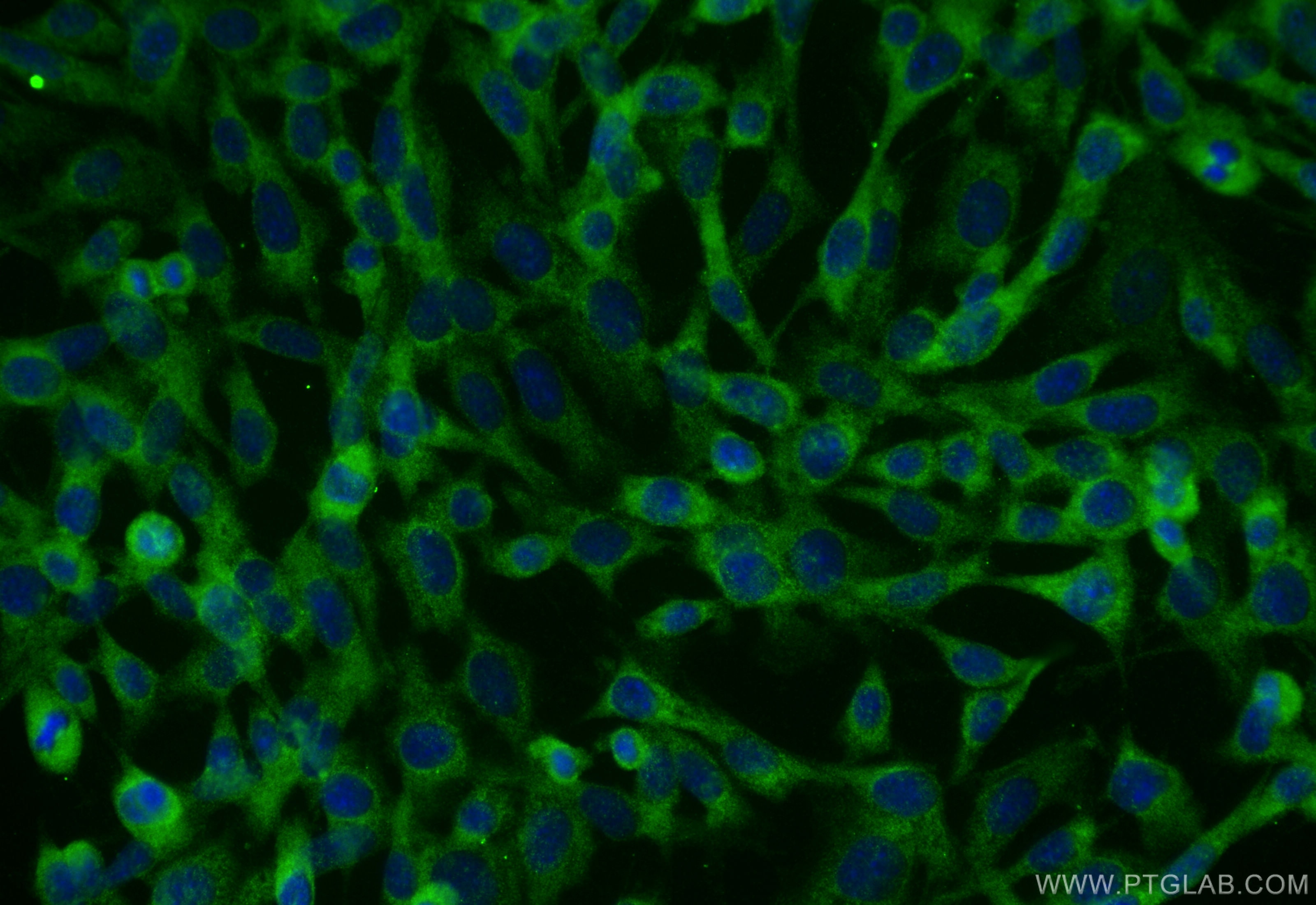 Immunofluorescence (IF) / fluorescent staining of NIH/3T3 cells using TGF beta 1 Polyclonal antibody (26155-1-AP)