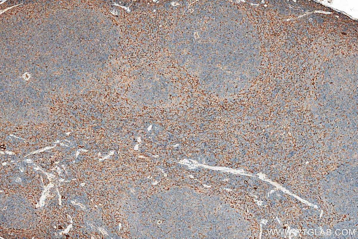 IHC staining of mouse spleen using 26155-1-AP Immunohistochemistry (IHC) staining of mouse spleen tissue using TGF beta 1 Polyclonal antibody (26155-1-AP)