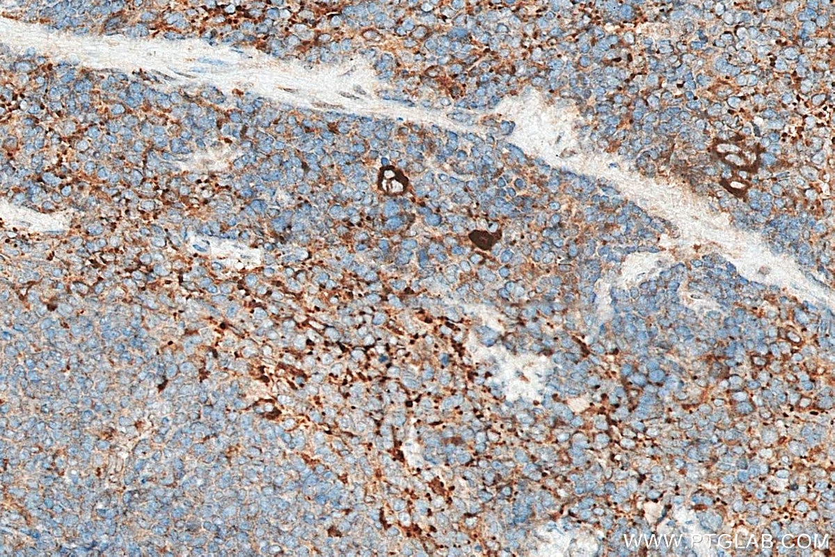 IHC staining of mouse spleen using 26155-1-AP Immunohistochemistry (IHC) staining of mouse spleen tissue using TGF beta 1 Polyclonal antibody (26155-1-AP)