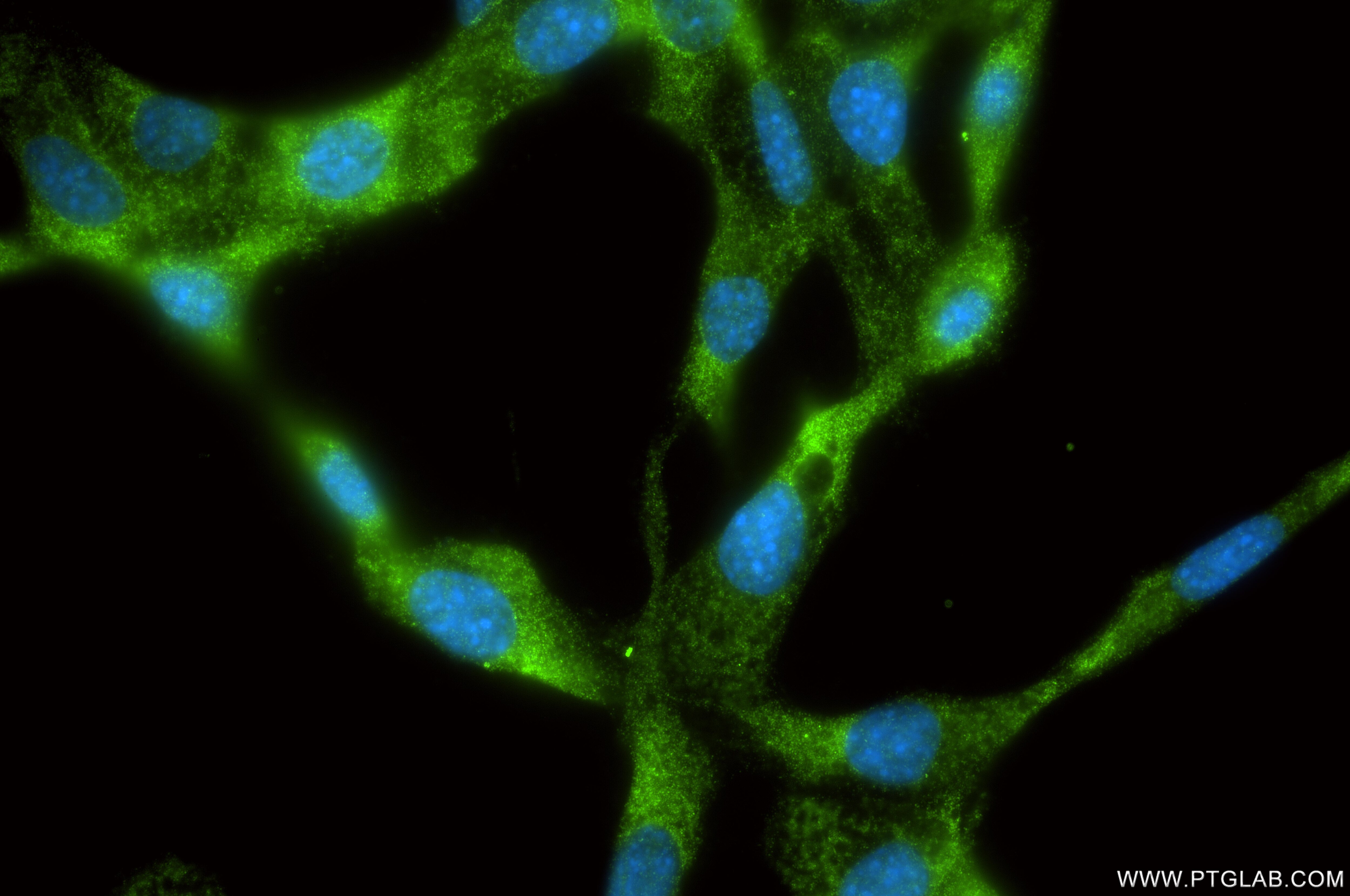 Immunofluorescence (IF) / fluorescent staining of NIH/3T3 cells using TGF beta 1 Recombinant monoclonal antibody (80458-2-RR)