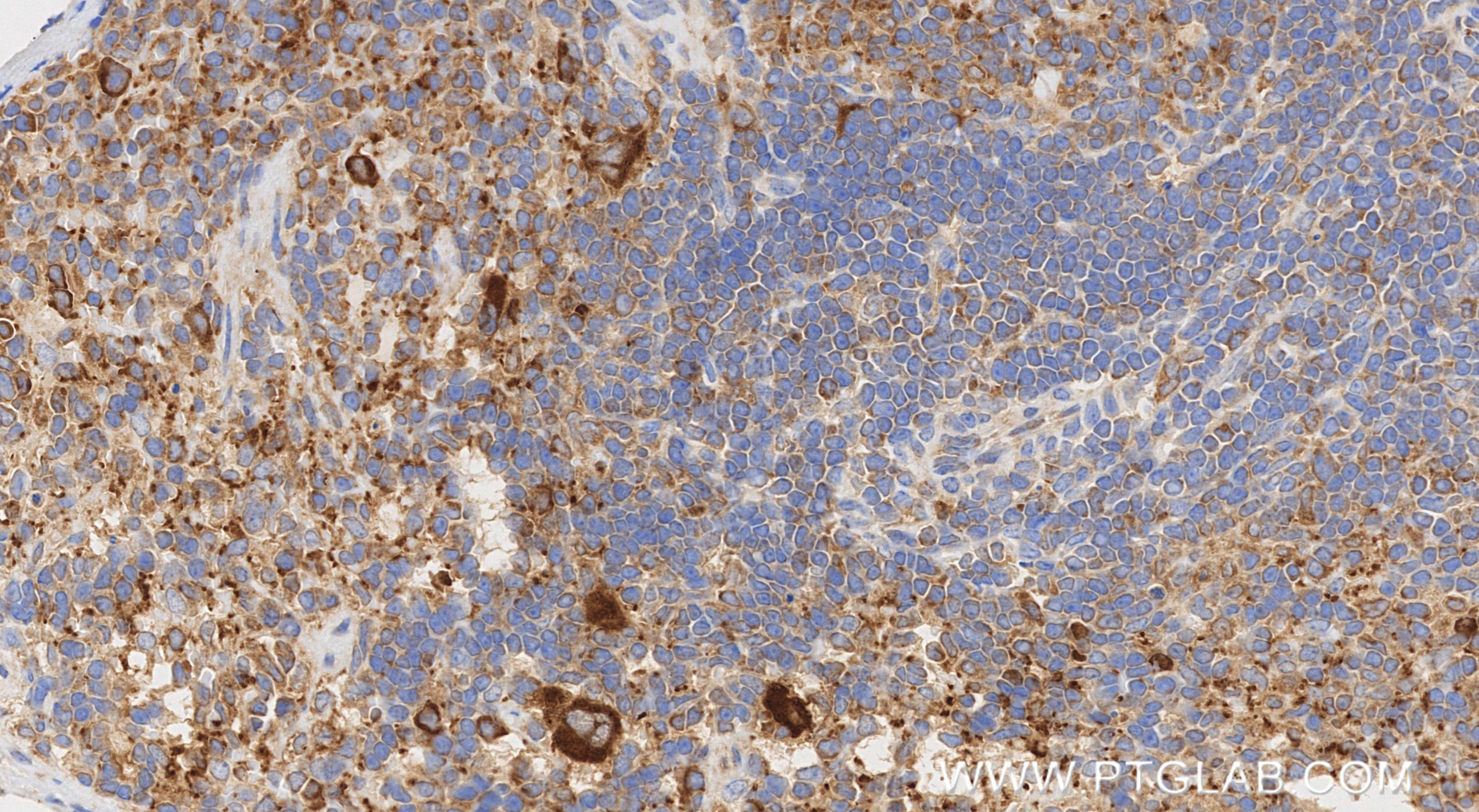 Immunohistochemistry (IHC) staining of mouse spleen tissue using TGF beta 1 Recombinant monoclonal antibody (80458-2-RR)