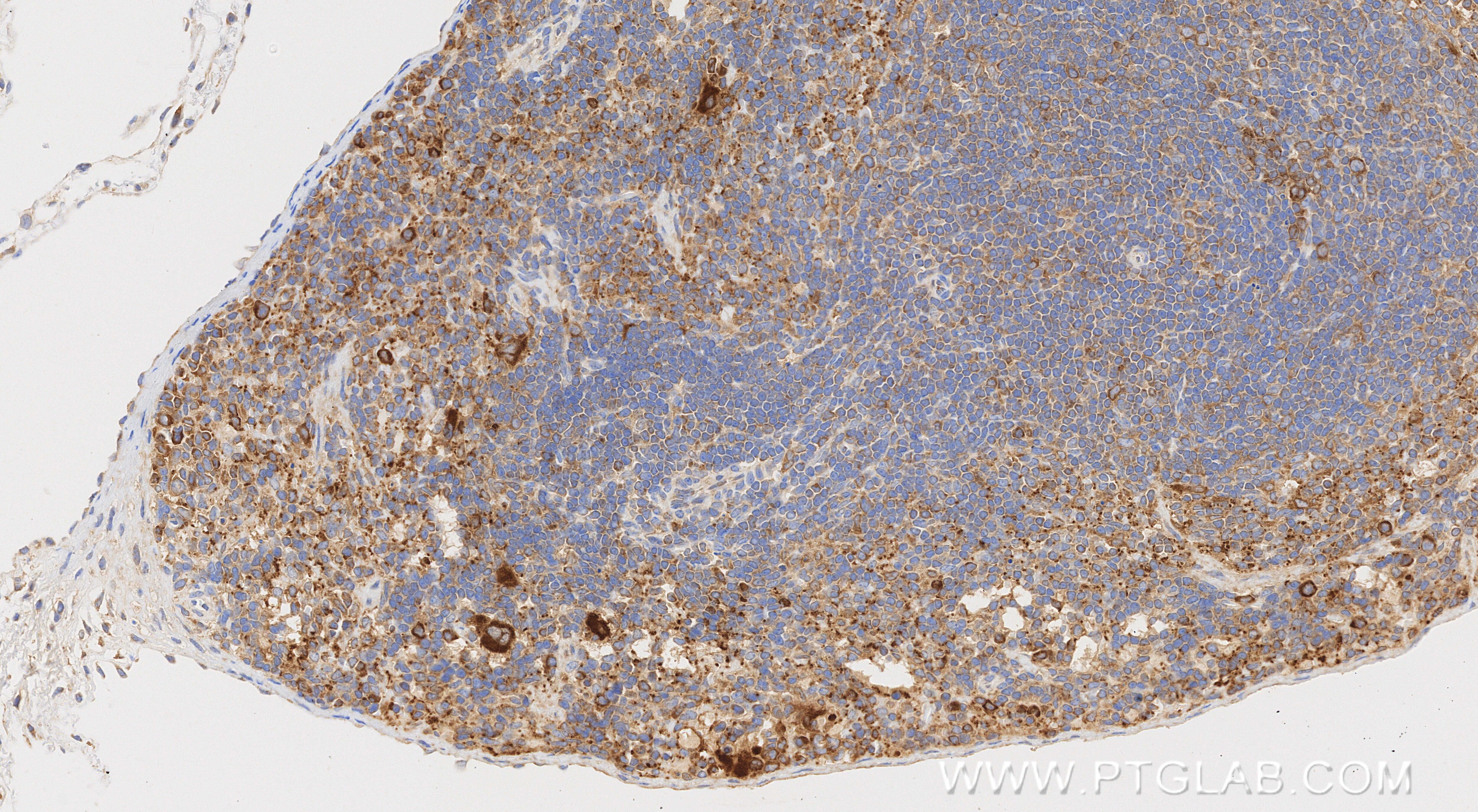 Immunohistochemistry (IHC) staining of mouse spleen tissue using TGF beta 1 Recombinant monoclonal antibody (80458-2-RR)